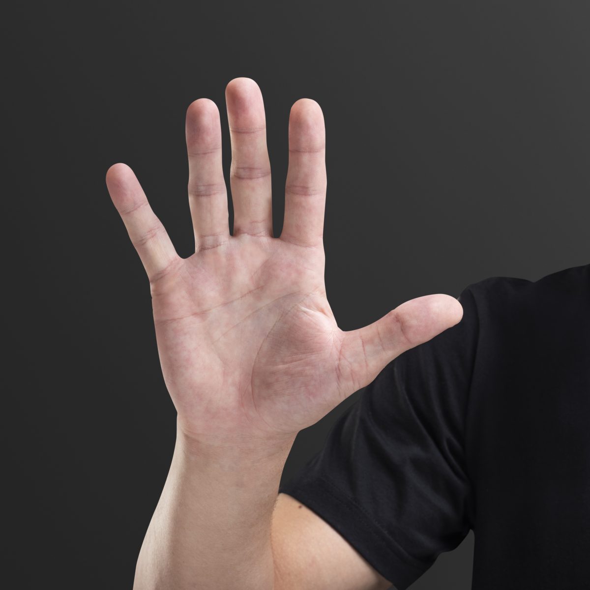 Picture of palm of hand